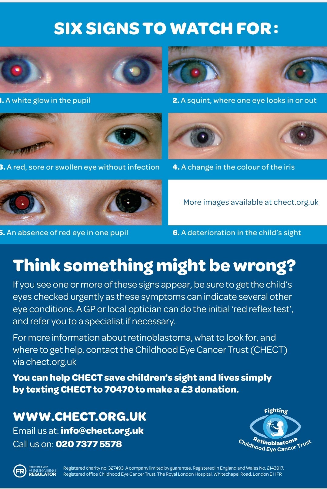 The signs to look out for with Retinoblastoma. 
